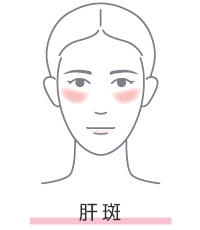 ǐFf