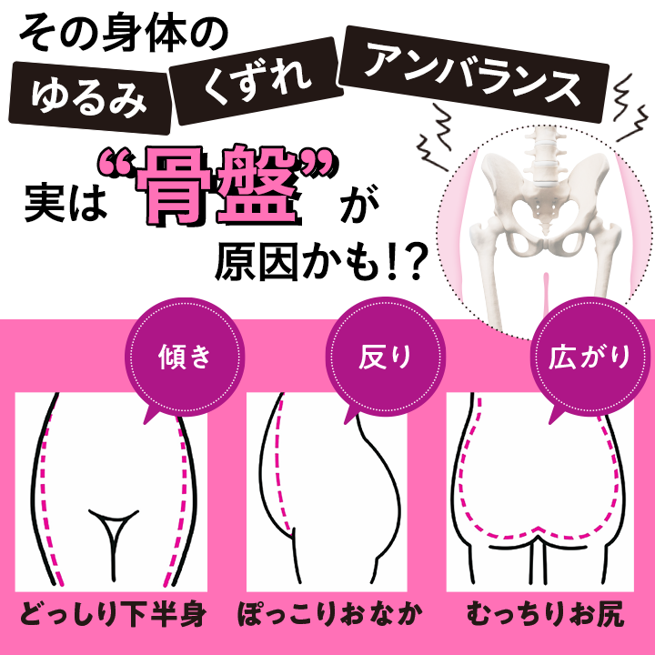 その身体のゆるみ・くずれ・アンバランス　実は骨盤が原因かも！？