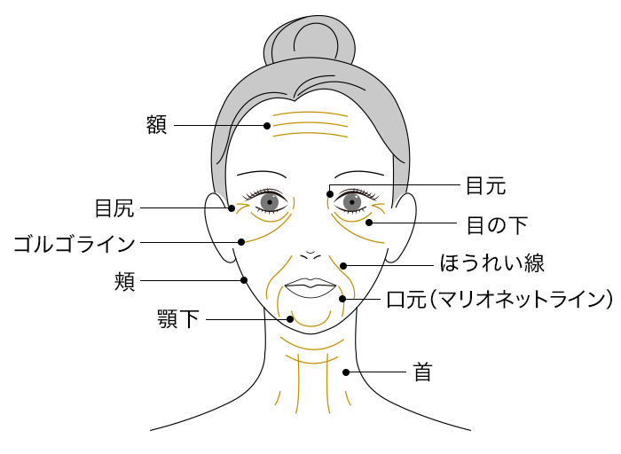 たるみが起こりやすいパーツ