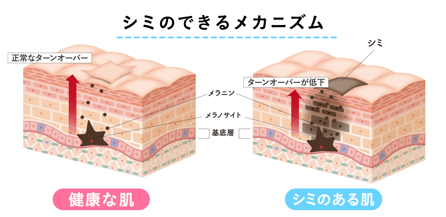シミのできるメカニズム
