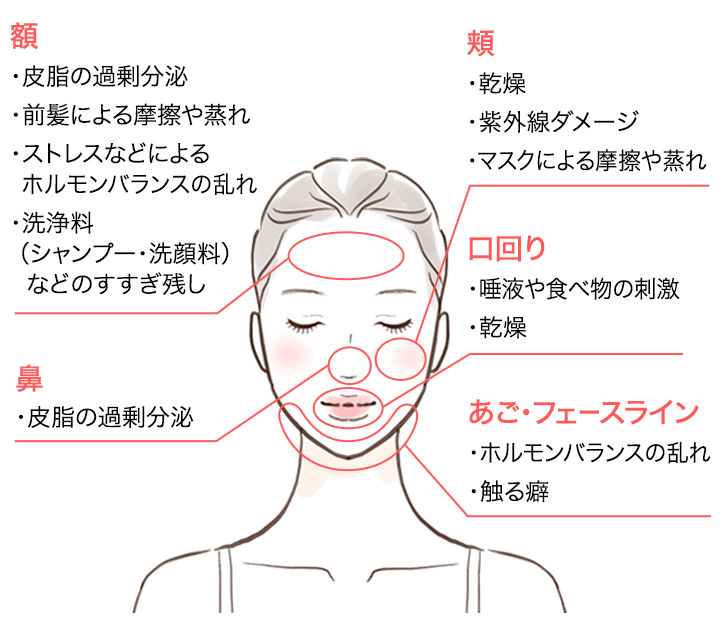 肌荒れが起こる場所ごとの原因