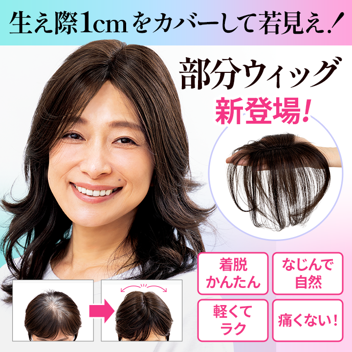生え際1cmをカバーして若見え！部分ウィッグ新登場