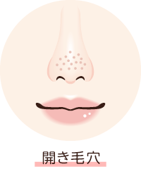 開き毛穴