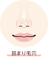 詰まり毛穴（黒ずみ・いちご鼻）