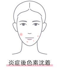 炎症性色素沈着