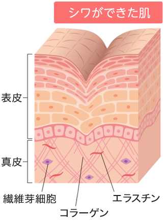 シワとは？ 下部