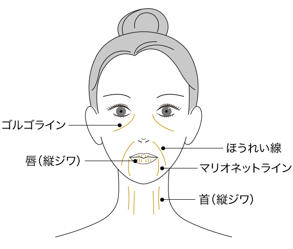 「ほうれい線」、「マリオネットライン」、「ゴルゴライン」、「首（縦ジワ）」、「唇（縦ジワ）」