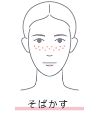 そばかす（雀卵斑）
