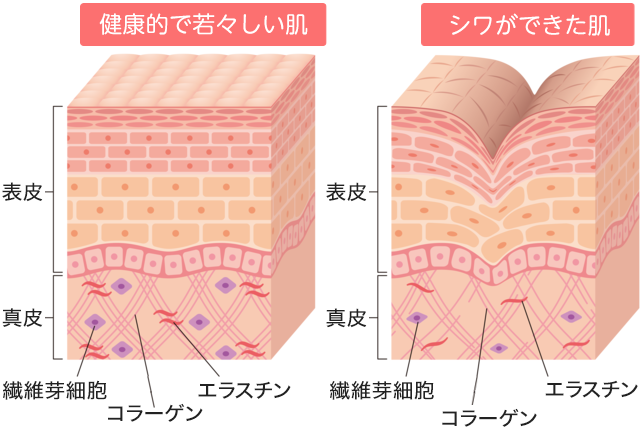 シワとは？