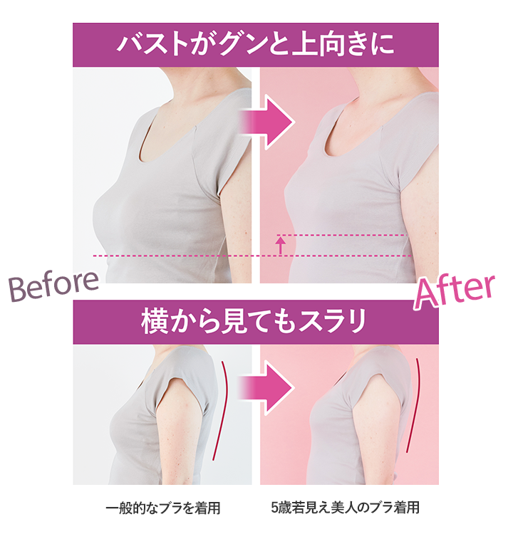 ビフォーアフター