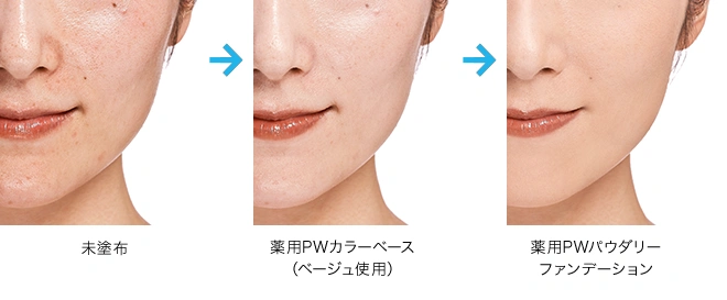before/after イメージ図